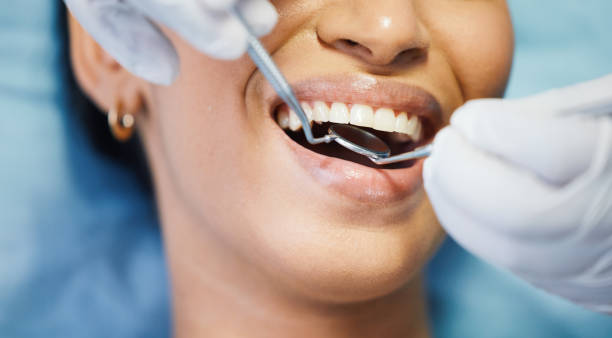 Best Emergency Dental Care for Broken or Chipped Teeth in Town And Country, MO