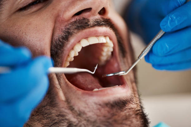 Best Emergency Tooth Extraction in Town And Country, MO
